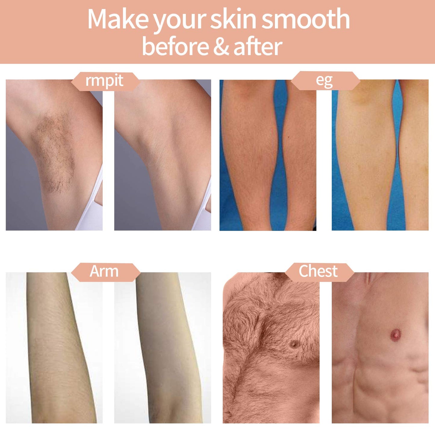 At home hair removal