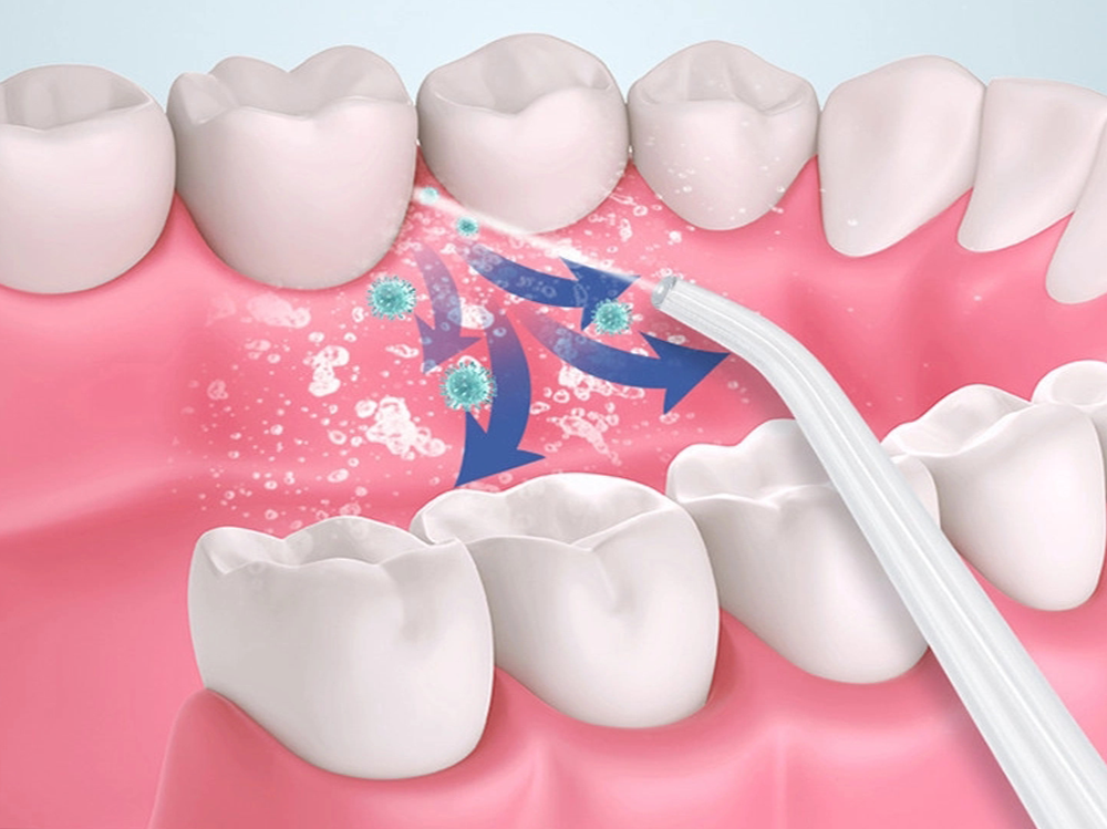 Portable Water Flosser Cordless