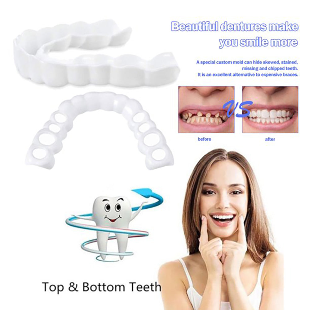 Top and bottom teeth fit