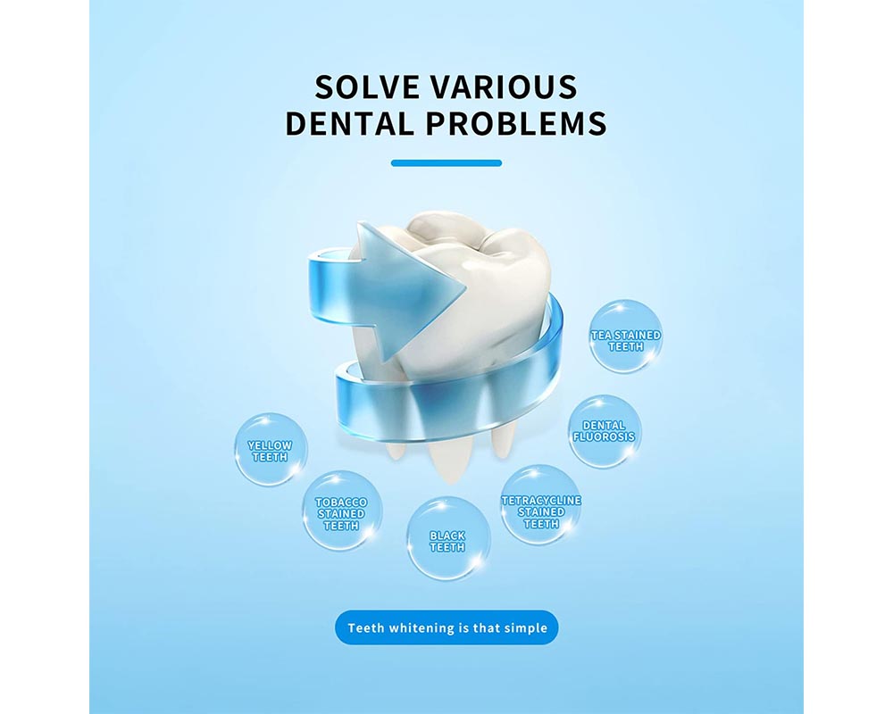 smilekit whitening set