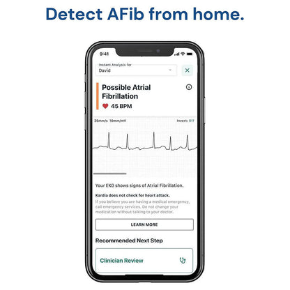 AliveCor KardiaMobile Smart ECG/EKG and Heart Monitor