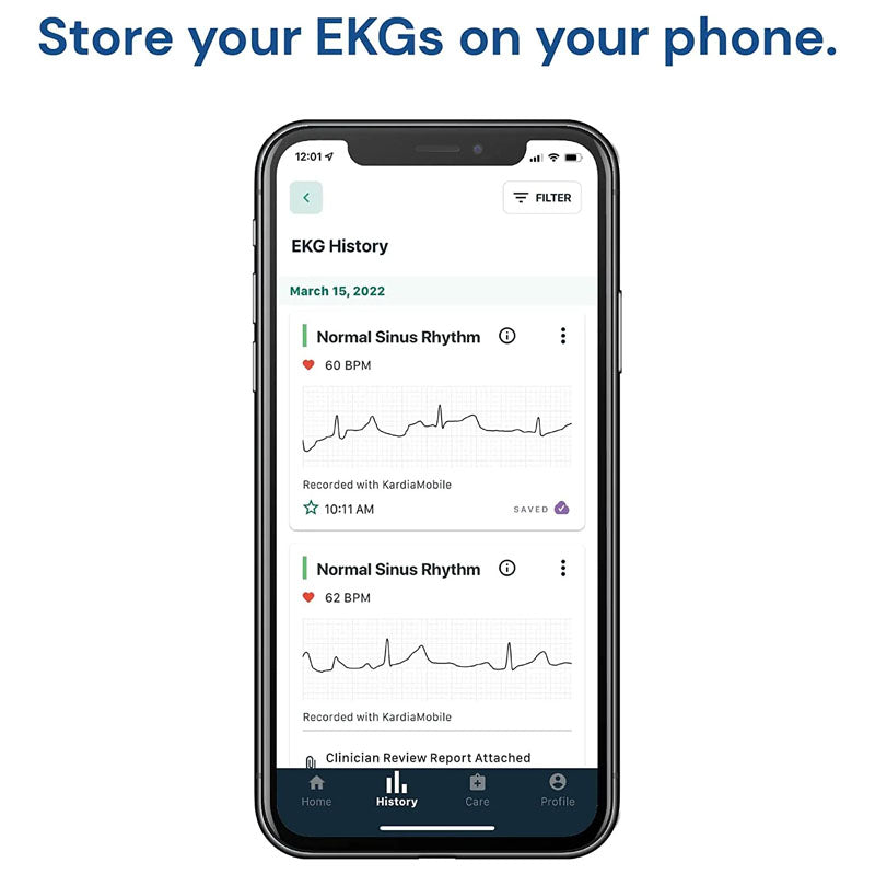 AliveCor KardiaMobile Smart ECG/EKG and Heart Monitor
