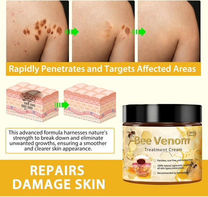 Bee Venom Moles and Warts Removal Cream