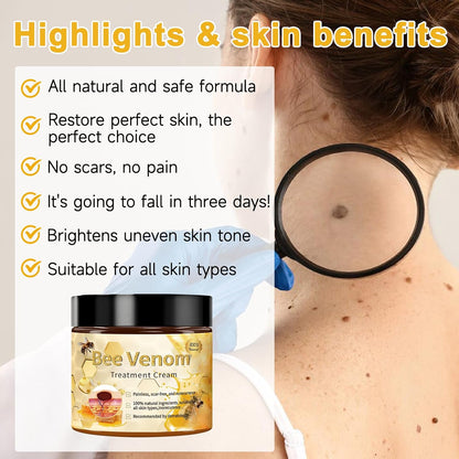 Bee Venom Moles and Warts Removal Cream