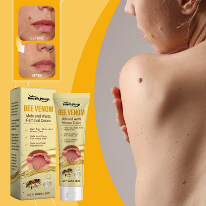 Bee Venom Skin Tag Remover