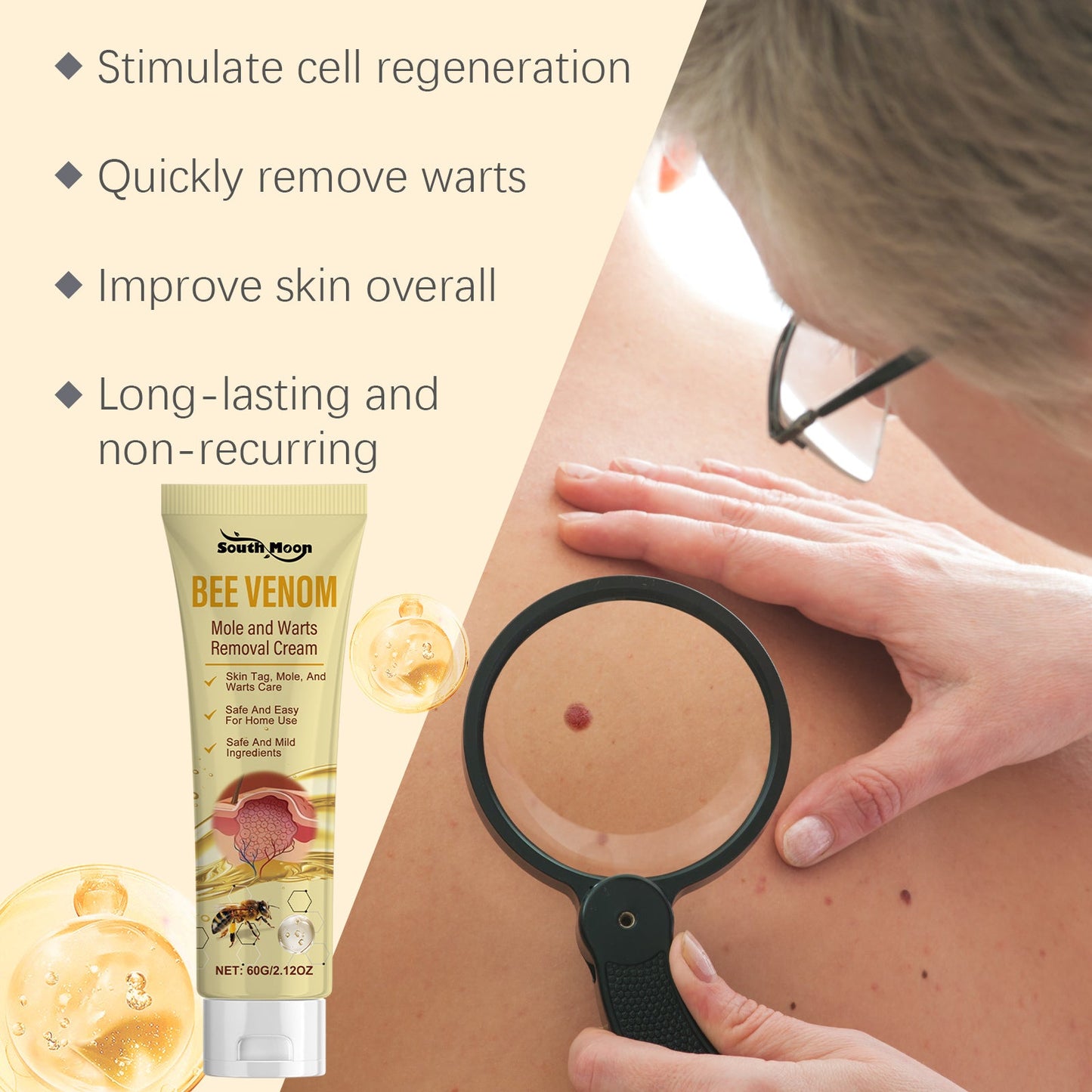 Bee Venom Skin Tag Remover
