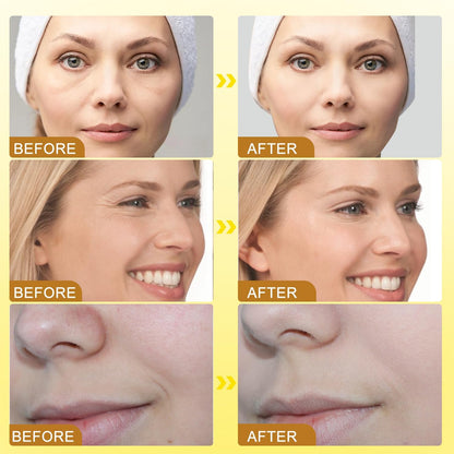 Bee Venom Botox Wrinkle Anti Aging Cream