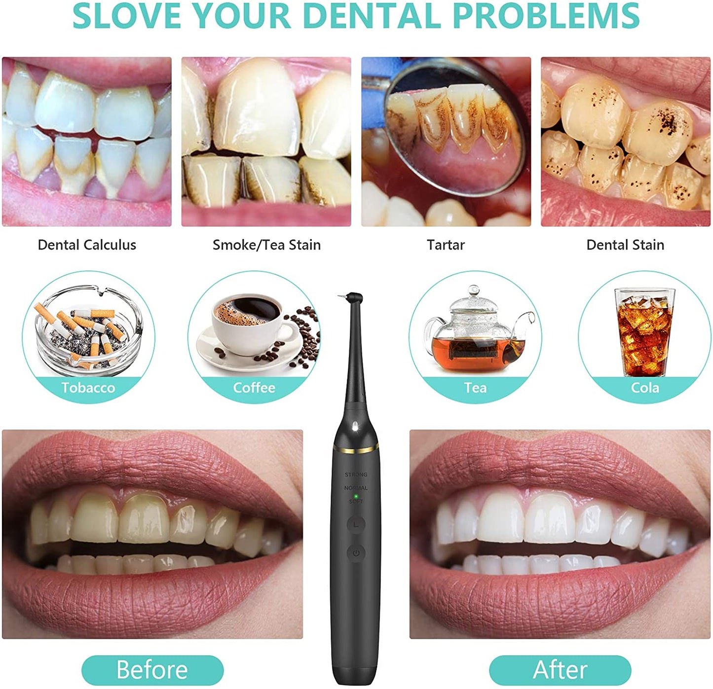 Electric Dental Calculus Remover Tooth Cleaner