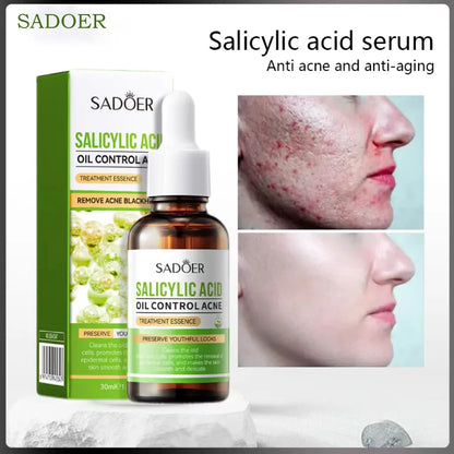 SADOER Salicylic Acid Oil Control Treatment Essence – 30ml