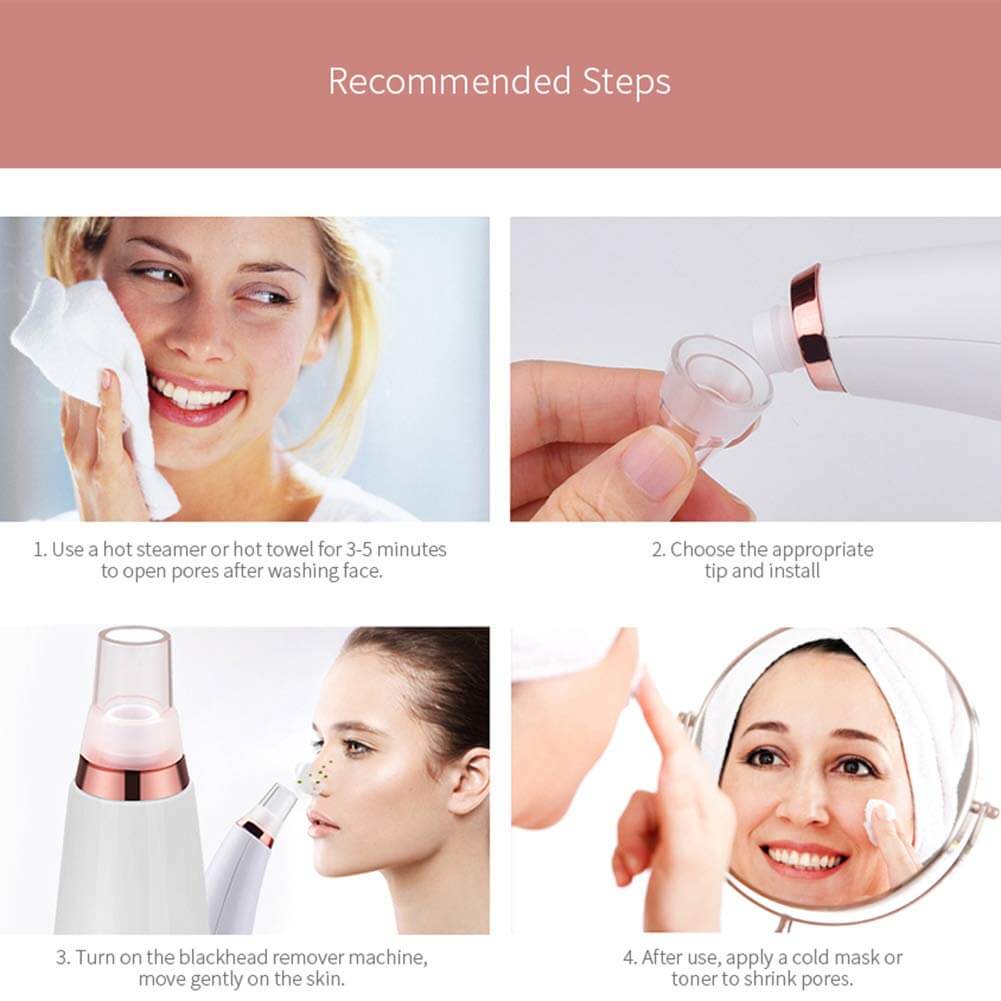 White blackhead remover