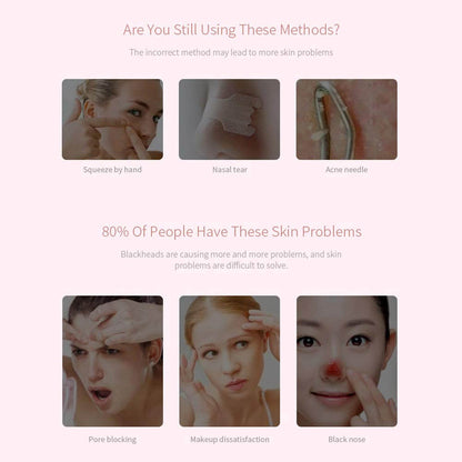 Skin elasticity device