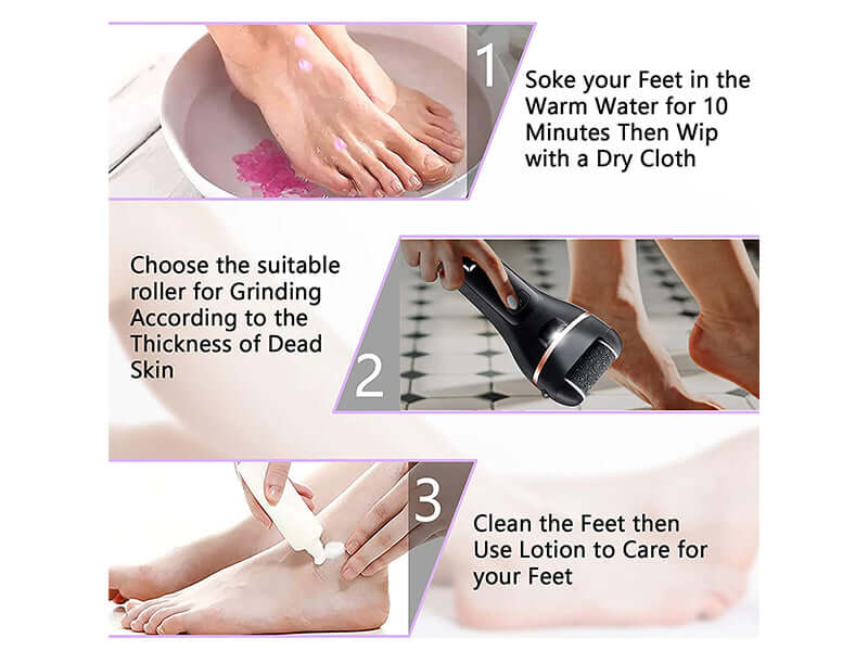 Coarse roller head for callus removal