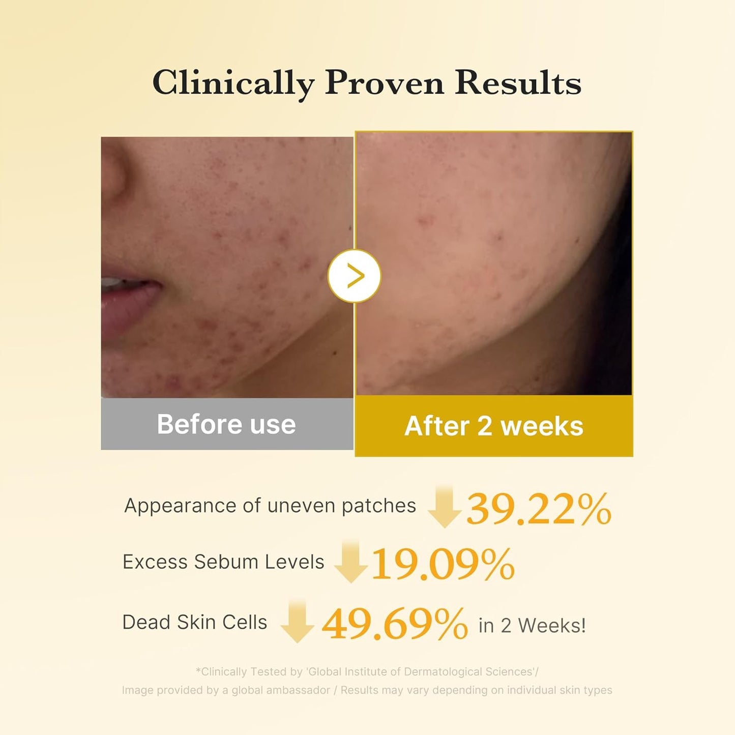 Medicube Arbutin & Turmeric Clarifying Toner Pads for Problem Skin