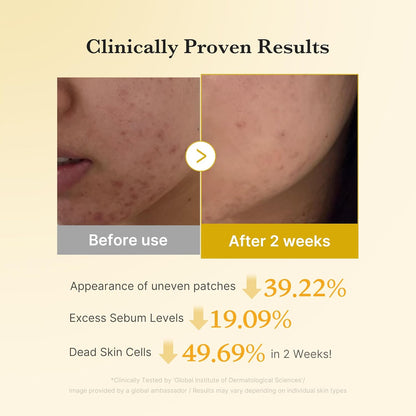 Medicube Arbutin & Turmeric Clarifying Toner Pads for Problem Skin