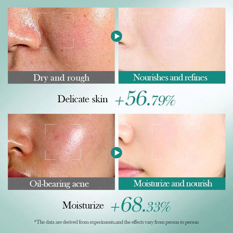 Hyaluronic Acid Moisturizing Repair Set Vitamin C Brightening Firming Facial Skin Care Face Cream
