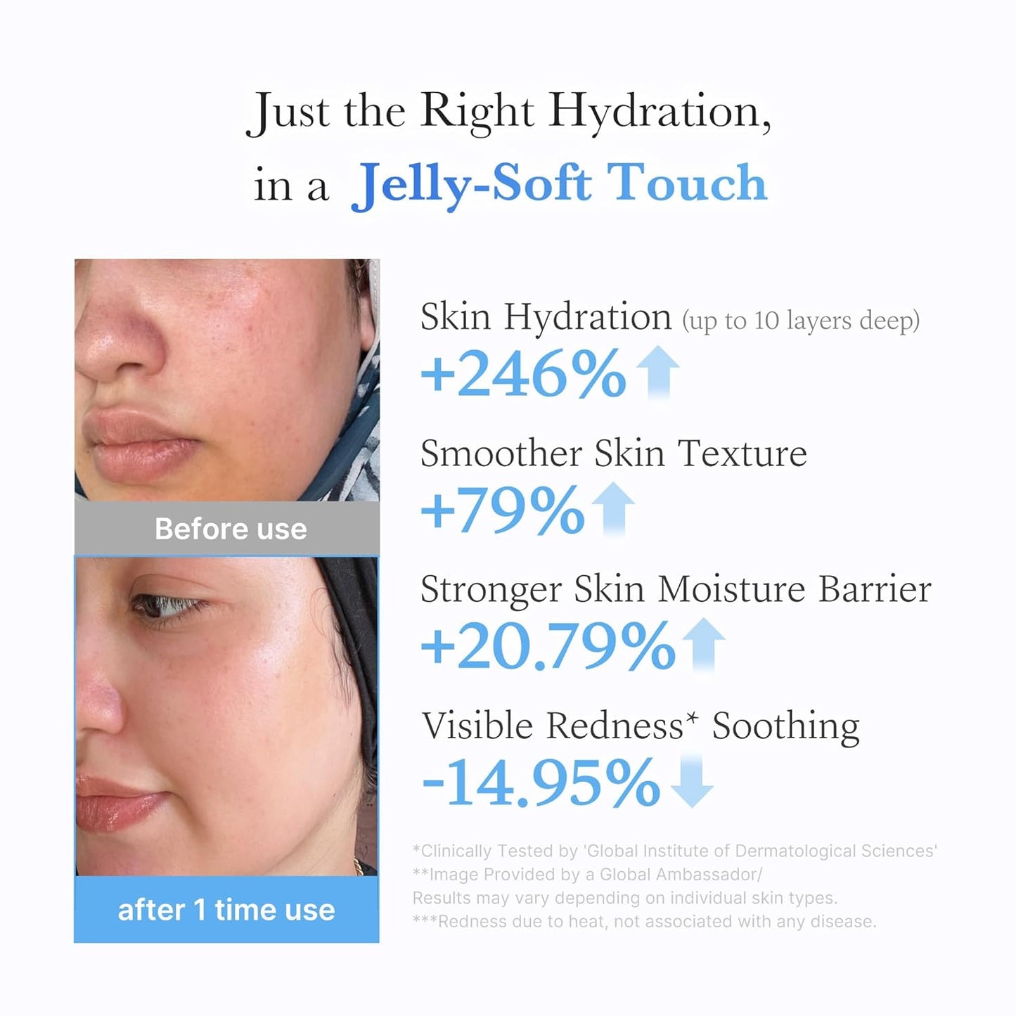 Medicube Acid Moisturizing Jelly Cream