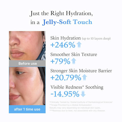 Medicube Acid Moisturizing Jelly Cream