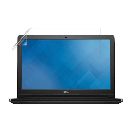 Hydrogel Screen Protector for Dell Vostro 15 3559