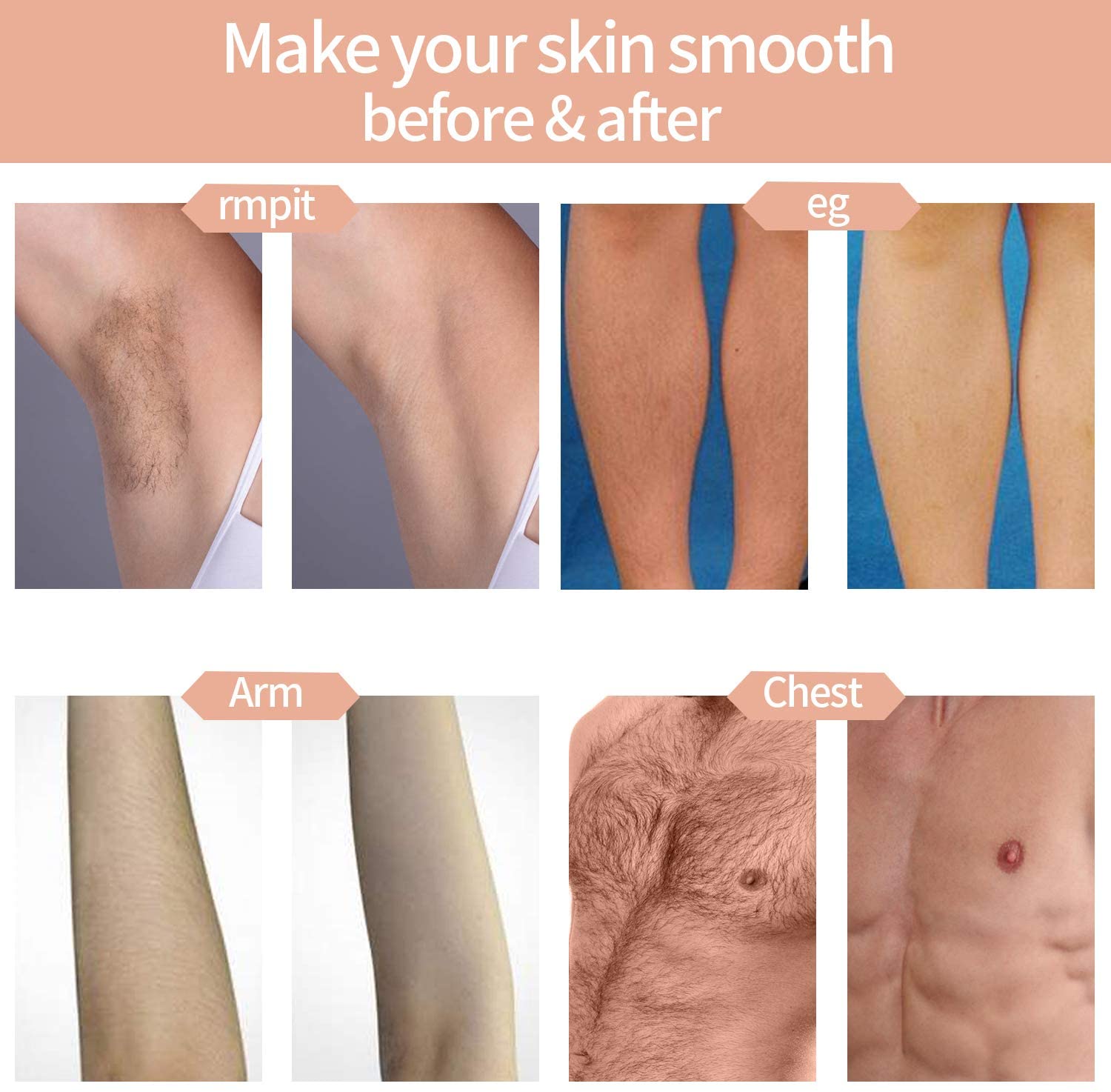 IPL for face and body