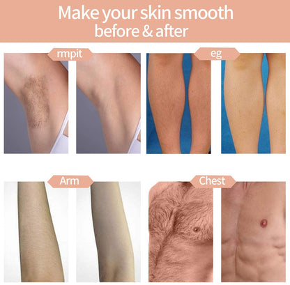 IPL for face and body