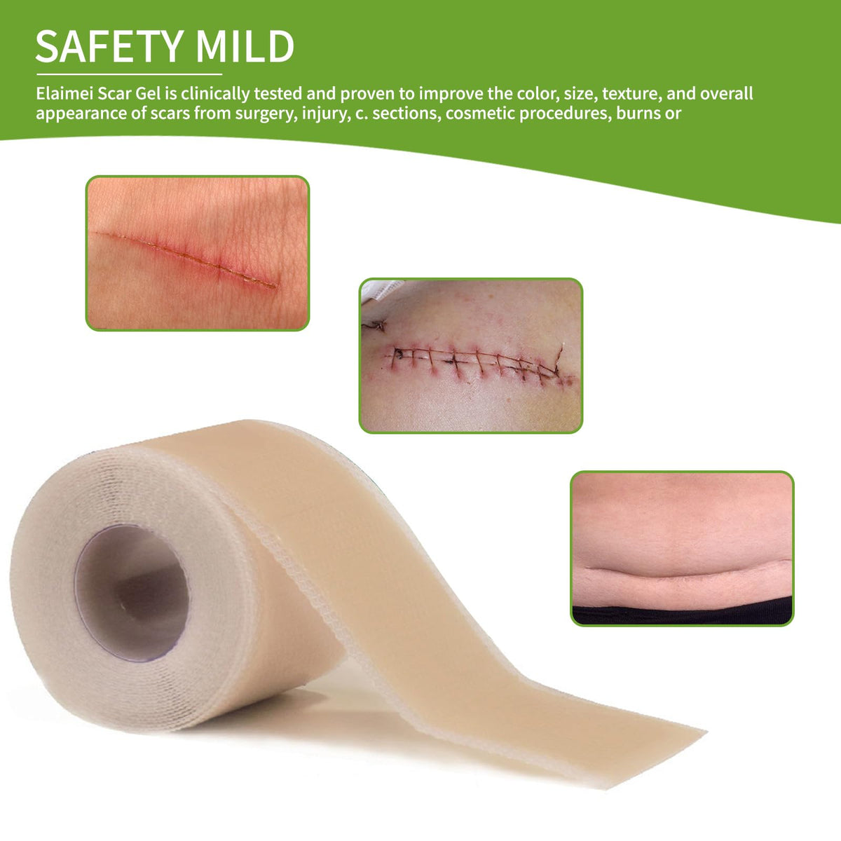 Silicone Scar Sheets