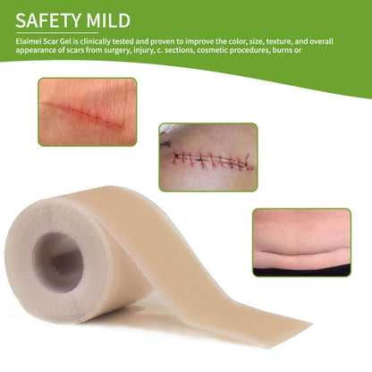 Silicone Scar Sheets