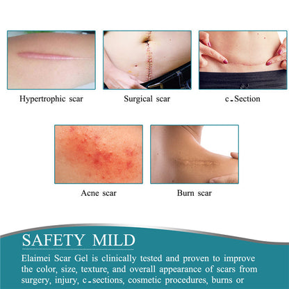 Silicone Scar Sheets