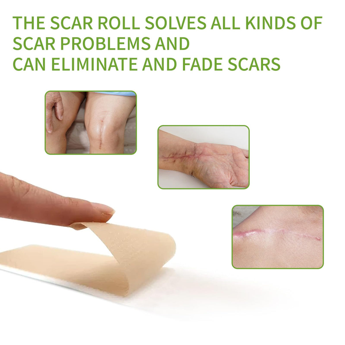 Silicone Scar Sheets