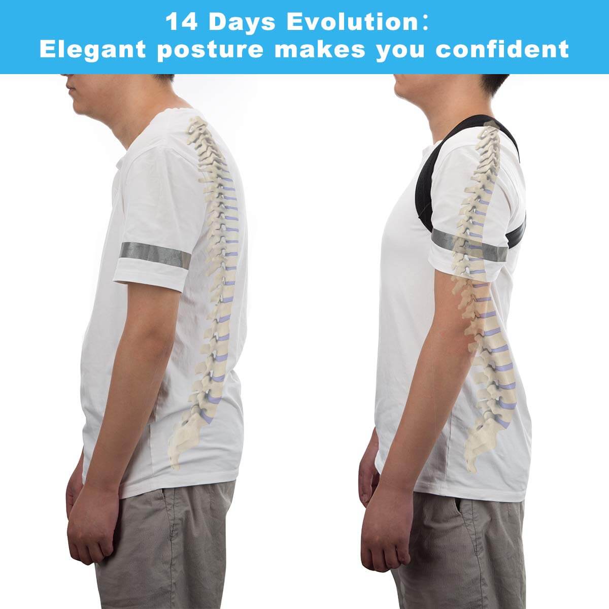 Posture corrector worn by woman