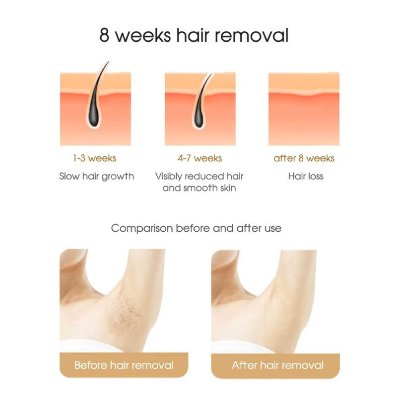 hair removal device side view