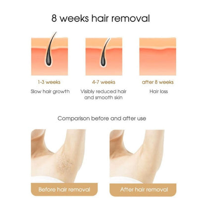 hair removal device side view