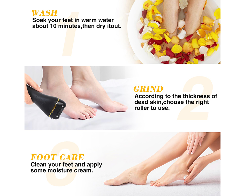 Foot pedicure kit with rollers