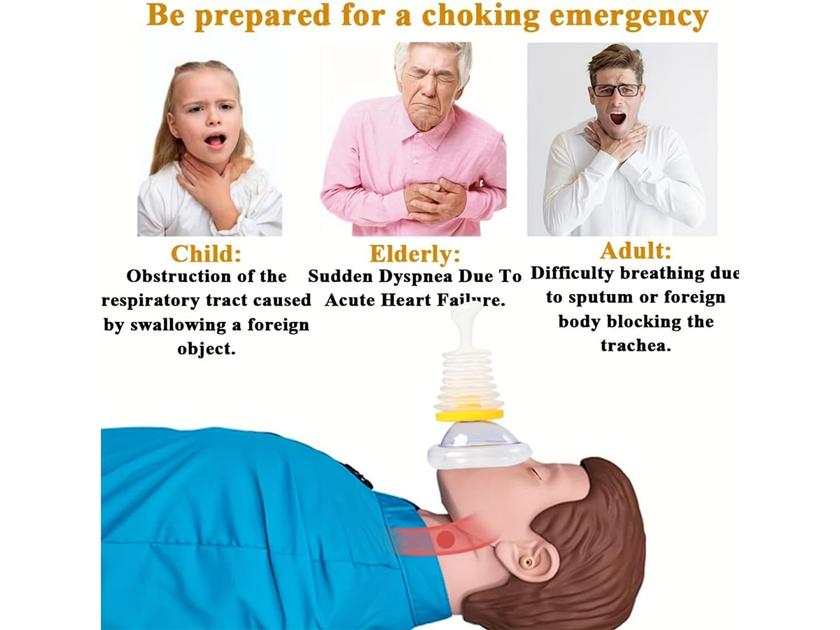 Anti Choking Device Portable Choking Rescue Device Emergency Airway Clearance Kit