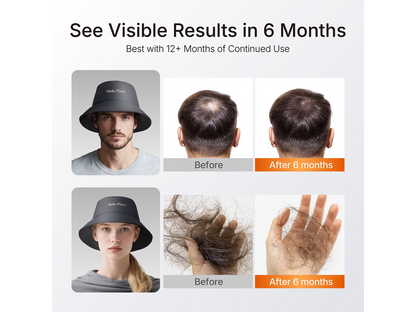 Red Light Therapy Hair Growth Cap