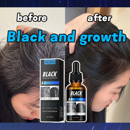 MOIKA Black Hair Serum for Hair Loss 30ml